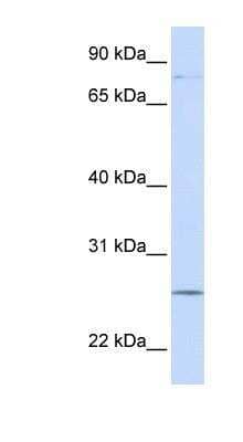 Western Blot: Protocadherin gamma C3 Antibody [NBP1-59233] - 721_B cell lysate, concentration 0.2-1 ug/ml.