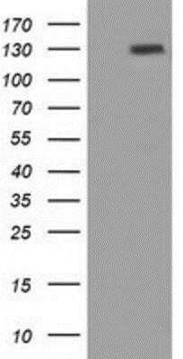 Western Blot: Protogenin Antibody (OTI2B3) - Azide and BSA Free [NBP2-73674] - HEK293T cells were transfected with the pCMV6-ENTRY control (Left lane) or pCMV6-ENTRY Protogenin (Right lane) cDNA for 48 hrs and lysed. Equivalent amounts of cell lysates (5 ug per lane) were separated by SDS-PAGE and immunoblotted with anti-Protogenin.