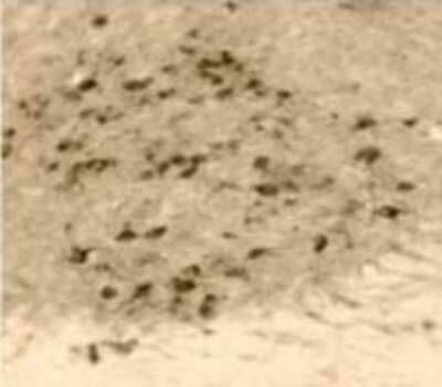 Immunohistochemistry: Pseudorabies Virus Antibody [NB120-3534] - Staining of rat hypothalamus from animals infected by injection of PRV into the vitreous body of the eye.