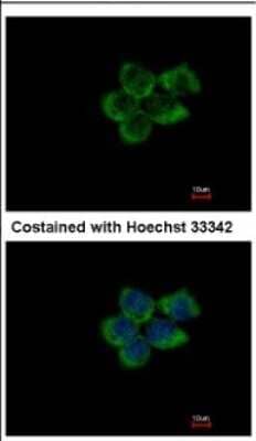 Immunocytochemistry/Immunofluorescence: PUM1 Antibody [NBP2-20011] - Analysis of methanol-fixed A431, using antibody at 1:500 dilution.