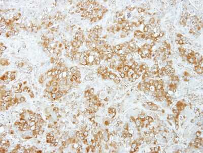 Immunohistochemistry-Paraffin: PUM1 Antibody [NBP2-20011] - H441 xenograft, using Pumilio 1 antibody at 1:100 dilution. Antigen Retrieval: Trilogy™ (EDTA based, pH 8.0) buffer, 15min.