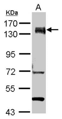 Western Blot: PUM1 Antibody [NBP2-20011] - Sample (30 ug of whole cell lysate) A: Jurkat 7. 5% SDS PAGE gel, diluted at 1:1000.