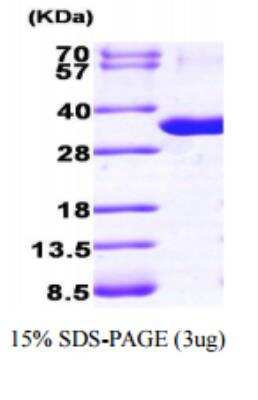 SDS-Page: Recombinant Human Purine Nucleoside Phosphorylase/PNP Protein [NBP1-50872]