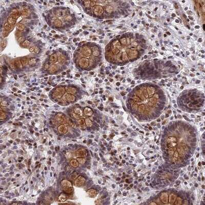 Immunohistochemistry-Paraffin: Pygopus-1 Antibody [NBP1-86218] - Staining of human colon shows moderate nuclear and cytoplasmic positivity in glandular cells.