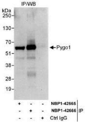 Immunoprecipitation: Pygopus-1 Antibody [NBP1-42665] - Whole cell lysate (1 mg for IP, 20% of IP loaded) from HeLa cells.   Affinity purified rabbit anti-Pygo1 antibody used for IP at 3 mcg/mg lysate.  Pygo1 was also immunoprecipitated by rabbit anti-Pygo1 antibody NBP1-42666, which recognizes a downstream epitope.
