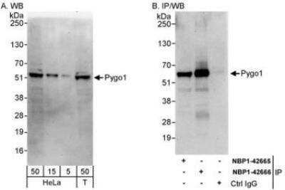 Western Blot: Pygopus-1 Antibody [NBP1-42666] - Whole cell lysate from HeLa (5, 15 and 50 mcg for WB; 1 mg for IP, 20% of IP loaded) and 293T (T; 50 mcg) cells.  Antibodies: Affinity purified rabbit anti-Pygo1 antibody used for WB at 0.04 mcg/ml (A) and 1 mcg/ml (B) and used for IP at 3 mcg/mg lysate.  Pygo1 was also immunoprecipitated by rabbit anti-Pygo1 antibody NBP1-42665, which recognizes an upstream epitope.