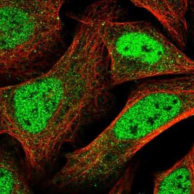 Immunocytochemistry/Immunofluorescence: Pyridoxal Kinase/PDXK Antibody [NBP1-88284] - Staining of human cell line U-2 OS shows localization to nucleoplasm. Antibody staining is shown in green.