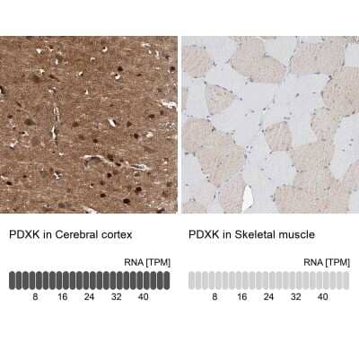 Immunohistochemistry-Paraffin: Pyridoxal Kinase/PDXK Antibody [NBP1-88284] - Analysis in human cerebral cortex and skeletal muscle tissues. Corresponding PDXK RNA-seq data are presented for the same tissues.