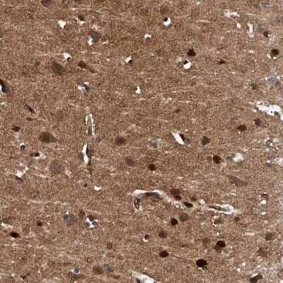 Immunohistochemistry-Paraffin: Pyridoxal Kinase/PDXK Antibody [NBP1-88284] - Staining of human cerebral cortex shows moderate to strong cytoplasmic positivity in neurons.