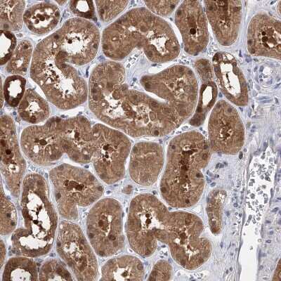 Immunohistochemistry-Paraffin: Pyridoxal Kinase/PDXK Antibody [NBP1-88284] - Staining of human kidney shows moderate cytoplasmic positivity in cells in tubules.