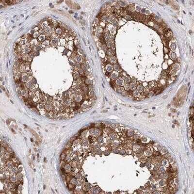 Immunohistochemistry-Paraffin: Pyridoxal Kinase/PDXK Antibody [NBP1-88284] - Staining of human testis shows moderate to strong cytoplasmic positivity in cells in seminiferous ducts.