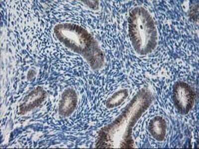 Immunohistochemistry: Pyridoxal Kinase/PDXK Antibody (OTI5H5) - Azide and BSA Free [NBP2-73754] - Staining of paraffin-embedded Human endometrium tissue using anti-PDXK mouse monoclonal antibody.