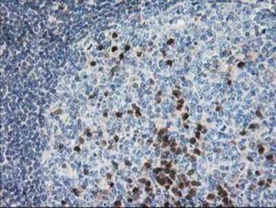 Immunohistochemistry: Pyridoxal Kinase/PDXK Antibody (OTI5H5) - Azide and BSA Free [NBP2-73754] - Staining of paraffin-embedded Human lymph node tissue using anti-PDXK mouse monoclonal antibody.