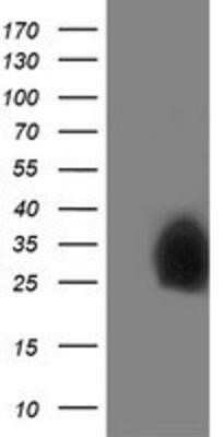 Western Blot: Pyridoxal Kinase/PDXK Antibody (OTI5H5) - Azide and BSA Free [NBP2-73754] - HEK293T cells were transfected with the pCMV6-ENTRY control (Left lane) or pCMV6-ENTRY PDXK (Right lane) cDNA for 48 hrs and lysed. Equivalent amounts of cell lysates (5 ug per lane) were separated by SDS-PAGE and immunoblotted with anti-PDXK.