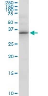 Western Blot: Pyridoxal Kinase/PDXK Antibody [H00008566-D01P] - Analysis of PDXK expression in A-431.