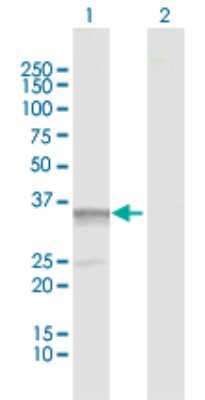 Western Blot: Pyridoxal Kinase/PDXK Antibody [H00008566-D01P] - Analysis of PDXK expression in transfected 293T cell line by PDXK polyclonal antibody.Lane 1: PDXK transfected lysate(35.10 KDa).Lane 2: Non-transfected lysate.