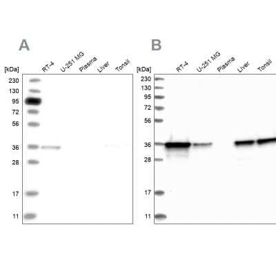 Western Blot: Pyridoxal Kinase/PDXK Antibody [NBP1-88282] - Analysis using Anti-PDXK antibody NBP1-88282 (A) shows similar pattern to independent antibody NBP1-88284 (B).