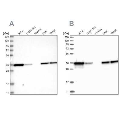 Western Blot: Pyridoxal Kinase/PDXK Antibody [NBP1-88283] - Analysis using Anti-PDXK antibody NBP1-88283 (A) shows similar pattern to independent antibody NBP1-88284 (B).