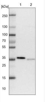 Western Blot: Pyridoxal Kinase/PDXK Antibody [NBP1-88284] - Lane 1: NIH-3T3 cell lysate (Mouse embryonic fibroblast cells)  Lane 2: NBT-II cell lysate (Rat Wistar bladder tumour cells)