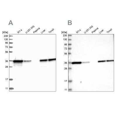 <b>Independent Antibodies Validation and Orthogonal Strategies Validation.</b>Western Blot: Pyridoxal Kinase/PDXK Antibody [NBP1-88284] - Analysis using Anti-PDXK antibody NBP1-88284 (A) shows similar pattern to independent antibody NBP1-88283 (B).