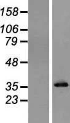 Western Blot: Pyrophosphatase Overexpression Lysate (Adult Normal) [NBL1-14622] Left-Empty vector transfected control cell lysate (HEK293 cell lysate); Right -Over-expression Lysate for Pyrophosphatase.