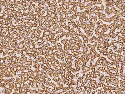Immunohistochemistry-Paraffin: Pyruvate Carboxylase Antibody [NBP3-06329] - Immunochemical staining of human Pyruvate Carboxylase in human liver with rabbit polyclonal antibody at 1:100 dilution, formalin-fixed paraffin embedded sections.