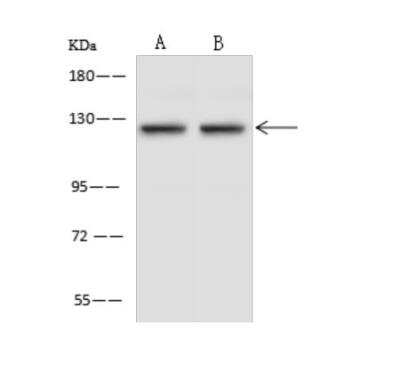 Western Blot: Pyruvate Carboxylase Antibody [NBP3-06329] - Anti-PC rabbit polyclonal antibody at 1:500 dilutionLane A: HeLa Whole Cell LysateLane B: A549 Whole Cell LysateLysates/proteins at 30 ug per lane.SecondaryGoat Anti-Rabbit IgG (H+L) HRP at 110000 dilution.Developed using the ECL technique.Performed under reducing conditions.Predicted band size:130 kDa