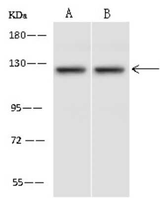Western Blot: Pyruvate Carboxylase Antibody [NBP3-06329] - Anti-Pyruvate Carboxylase rabbit polyclonal antibody at 1:500 dilution.