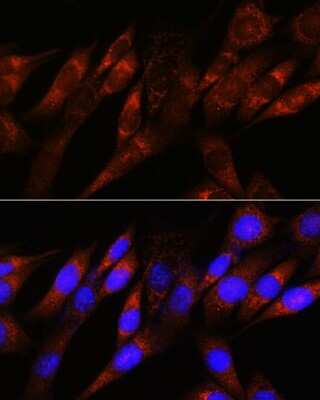 Immunocytochemistry/Immunofluorescence: Pyruvate Dehydrogenase E1-alpha subunit Antibody (8Z4N6) [NBP3-15470] - Immunofluorescence analysis of NIH-3T3 cells using Pyruvate Dehydrogenase E1-alpha subunit Rabbit mAb (NBP3-15470) at dilution of 1:100 (40x lens). Blue: DAPI for nuclear staining.