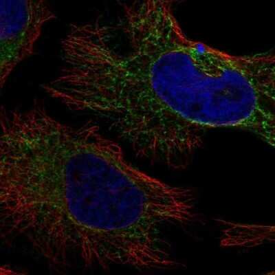 Immunocytochemistry/Immunofluorescence: Pyruvate Dehydrogenase E1-alpha subunit Antibody [NBP2-33922] - PDHA2 Antibody [NBP2-33922] - Staining of human cell line HeLa shows localization to mitochondria. Antibody staining is shown in green.