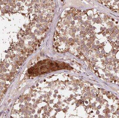 Immunohistochemistry-Paraffin: Pyruvate Dehydrogenase E1-alpha subunit Antibody [NBP2-54747] - Staining of human testis shows moderate cytoplasmic positivity in cells in seminiferous ducts, Leydig cells were strongly stained.