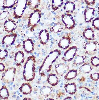 Immunohistochemistry-Paraffin: Pyruvate Dehydrogenase E1-alpha subunit Antibody [NBP2-95251] - Rat kidney using PDHA1 Rabbit pAb at dilution of 1:100 (40x lens).