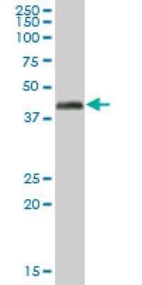 Western Blot: Pyruvate Dehydrogenase E1-alpha subunit Antibody [H00005160-B01P] - PDHA1 MaxPab polyclonal antibody. Western Blot analysis of PDHA1 expression in human liver.