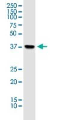 Western Blot: Pyruvate Dehydrogenase E1-alpha subunit Antibody [H00005160-B01P] - Analysis of PDHA1 expression in HeLa.