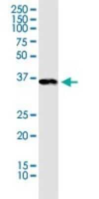 Western Blot: Pyruvate Dehydrogenase E1-alpha subunit Antibody [H00005160-B01P] - Analysis of PDHA1 expression in NIH/3T3.