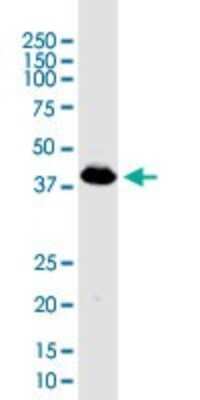 Western Blot: Pyruvate Dehydrogenase E1-alpha subunit Antibody [H00005160-B01P] - Analysis of PDHA1 expression in human kidney.