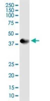 Western Blot: Pyruvate Dehydrogenase E1-alpha subunit Antibody [H00005160-B01P] - Analysis of PDHA1 expression in rat brain.