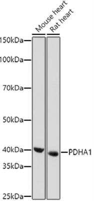 Western Blot: Pyruvate Dehydrogenase E1-alpha subunit Antibody [NBP2-95251] - Analysis of extracts of various cell lines, using PDHA1 antibody at 1:1000 dilution.Secondary antibody: HRP Goat Anti-Rabbit IgG (H+L) at 1:10000 dilution.Lysates/proteins: 25ug per lane. Blocking buffer: 3% nonfat dry milk in TBST.Detection: ECL Basic Kit. Exposure time: 180s.