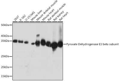 Western Blot: Pyruvate Dehydrogenase E1 beta subunit Antibody (7V8O5) [NBP3-16455] - Western blot analysis of extracts of various cell lines, using Pyruvate Dehydrogenase E1 beta subunit Rabbit mAb (NBP3-16455) at 1:1000 dilution. Secondary antibody: HRP Goat Anti-Rabbit IgG (H+L) at 1:10000 dilution. Lysates/proteins: 25ug per lane. Blocking buffer: 3% nonfat dry milk in TBST. Detection: ECL Basic Kit. Exposure time: 10s.