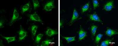 Immunocytochemistry/Immunofluorescence: Pyruvate Dehydrogenase E1 beta subunit Antibody [NBP2-20024] - Pyruvate Dehydrogenase E1 beta subunit antibody detects Pyruvate Dehydrogenase E1 beta subunit protein at mitochondria by immunofluorescent analysis. Sample: HeLa cells were fixed in ice-cold MeOH for 5 min. Green: Pyruvate Dehydrogenase E1 beta subunit protein stained by Pyruvate Dehydrogenase E1 beta subunit antibody diluted at 1:500. Blue: Hoechst 33342 staining. Scale bar = 10 um.