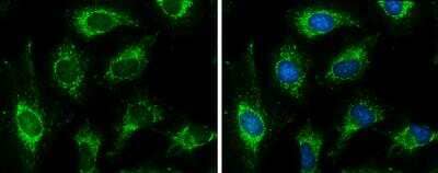 Immunocytochemistry/Immunofluorescence: Pyruvate Dehydrogenase E1 beta subunit Antibody [NBP2-20025] - Pyruvate Dehydrogenase E1 beta subunit Antibody detects Pyruvate Dehydrogenase E1 beta subunit protein at mitochondria by immunofluorescent analysis. Sample: HeLa cells were fixed in ice-cold MeOH for 5 min. Green: Pyruvate Dehydrogenase E1 beta subunit protein stained by Pyruvate Dehydrogenase E1 beta subunit Antibody diluted at 1:500. Blue: Hoechst 33342 staining.