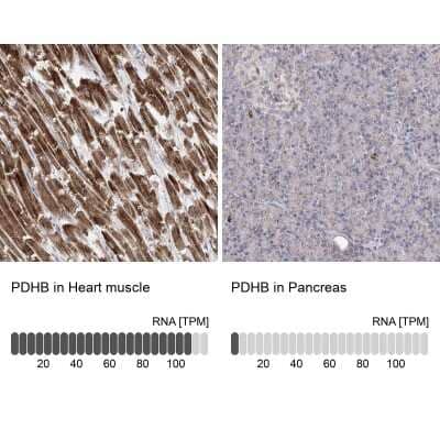 <b>Orthogonal Strategies Validation. </b>Immunohistochemistry-Paraffin: Pyruvate Dehydrogenase E1 beta subunit Antibody [NBP1-87421] - Staining in human heart muscle and pancreas tissues using anti-PDHB antibody. Corresponding PDHB RNA-seq data are presented for the same tissues.