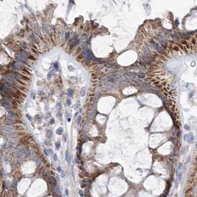 Immunohistochemistry-Paraffin: Pyruvate Dehydrogenase E1 beta subunit Antibody [NBP1-87421] - Staining of human colon.