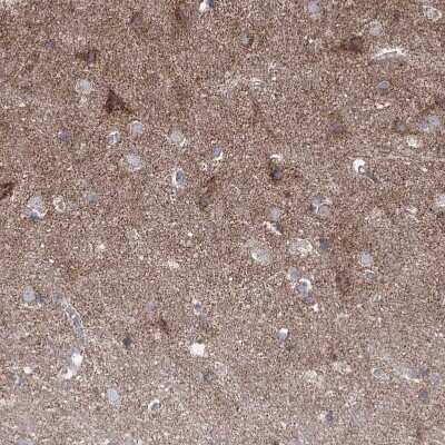 Immunohistochemistry-Paraffin: Pyruvate Dehydrogenase E1 beta subunit Antibody [NBP1-87421] - Staining of human cerebral cortex shows moderate positivity in neuropil.