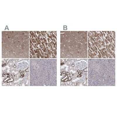 <b>Independent Antibodies Validation. </b>Immunohistochemistry-Paraffin: Pyruvate Dehydrogenase E1 beta subunit Antibody [NBP1-87421] - Staining of human cerebral cortex, heart muscle, kidney and pancreas using Anti-Pyruvate Dehydrogenase E1 beta subunit antibody NBP1-87421 (A) shows similar protein distribution across tissues to independent antibody NBP2-38327 (B).