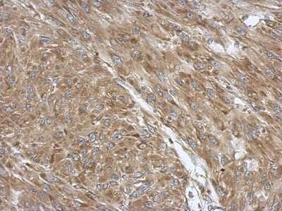 Immunohistochemistry-Paraffin: Pyruvate Dehydrogenase E1 beta subunit Antibody [NBP2-20024] - Immunohistochemical analysis of paraffin-embedded U87 xenograft, using antibody at 1:500 dilution.