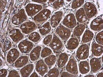 Immunohistochemistry-Paraffin: Pyruvate Dehydrogenase E1 beta subunit Antibody [NBP2-20024] - Pyruvate Dehydrogenase E1 beta subunit antibody detects Pyruvate Dehydrogenase E1 beta subunit protein at cytoplasm in mouse intestine by immunohistochemical analysis. Sample: Paraffin-embedded mouse intestine. Pyruvate Dehydrogenase E1 beta subunit antibody diluted at 1:500. Antigen Retrieval: Citrate buffer, pH 6.0, 15 min