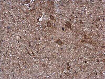 Immunohistochemistry-Paraffin: Pyruvate Dehydrogenase E1 beta subunit Antibody [NBP2-20024] - Pyruvate Dehydrogenase E1 beta subunit antibody detects Pyruvate Dehydrogenase E1 beta subunit protein at cytoplasm in mouse brain by immunohistochemical analysis. Sample: Paraffin-embedded mouse brain. Pyruvate Dehydrogenase E1 beta subunit antibody diluted at 1:500. Antigen Retrieval: Citrate buffer, pH 6.0, 15 min