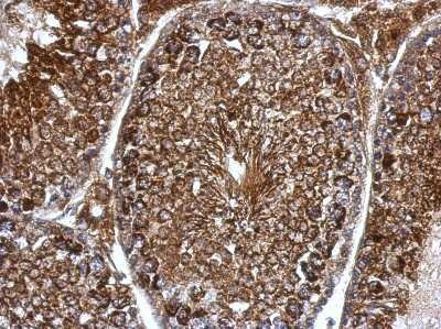 Immunohistochemistry-Paraffin: Pyruvate Dehydrogenase E1 beta subunit Antibody [NBP2-20025] - Immunohistochemical analysis of paraffin-embedded Testis, using antibody at 1:500 dilution.