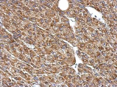 Immunohistochemistry-Paraffin: Pyruvate Dehydrogenase E1 beta subunit Antibody [NBP2-20025] - Immunohistochemical analysis of paraffin-embedded U87 xenograft, using antibody at 1:500 dilution.